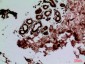 CEACAM1/5 Polyclonal Antibody